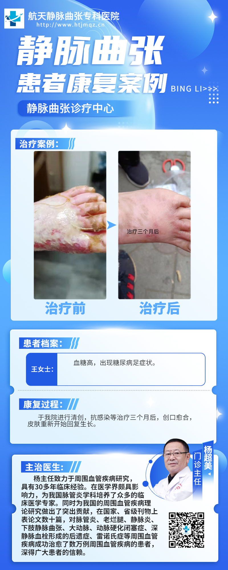 糖尿病足