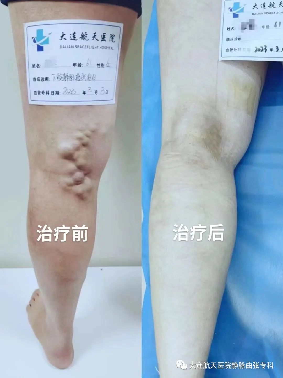 治疗前后