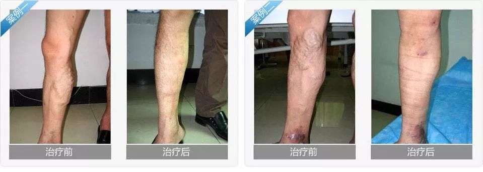治愈前后