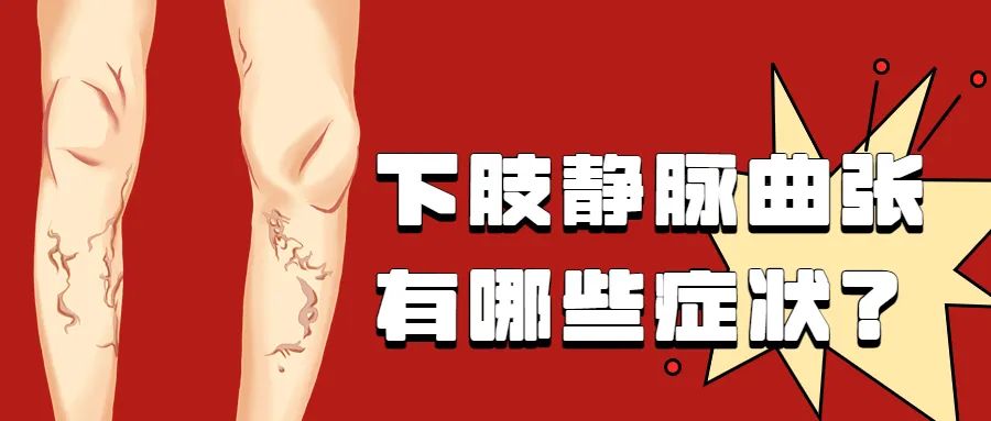 下肢静脉曲张有那些症状