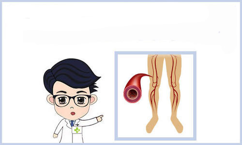 脉管炎的诊断依据是什么?早期症状又是什么样的? 