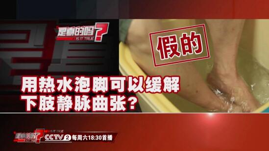 用热水泡脚可以缓解下肢静脉曲张？