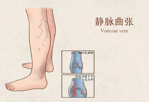 卡通脚
