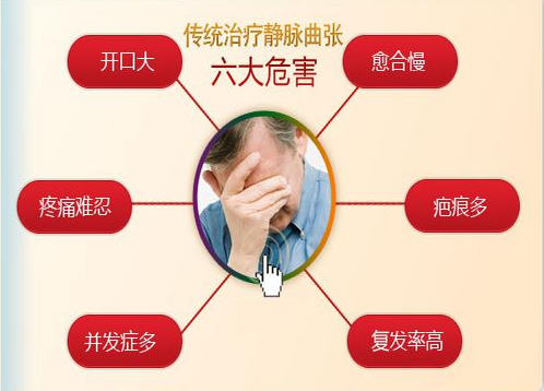 大连哪里治疗静脉曲张