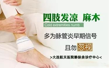 脉管炎怎么治疗最好？