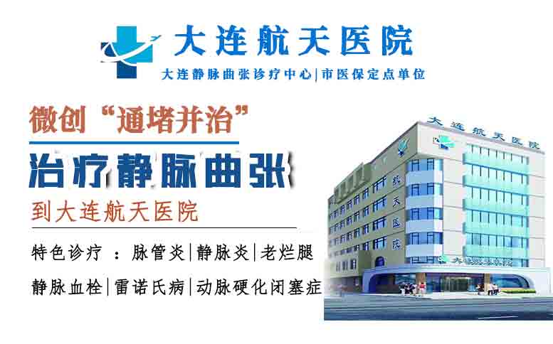 小腿肿痛瘙痒是静脉曲张吗？