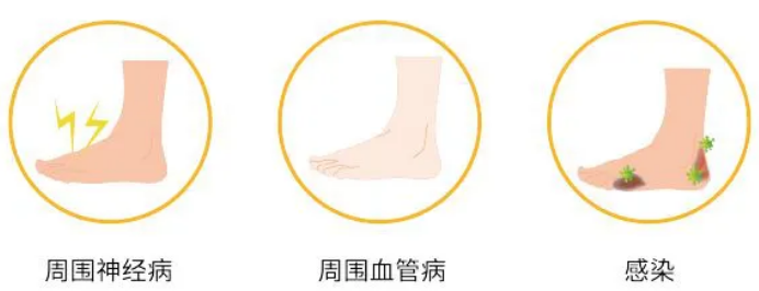 大连静脉曲张专科医院丨糖尿病足知多少？