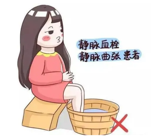 怎样治疗静脉曲张“蚯蚓腿”好得快?