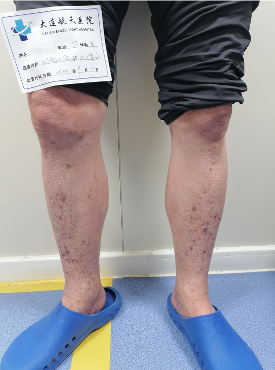 王宝珠:天气渐冷，腿部疼痛一定不要忽视