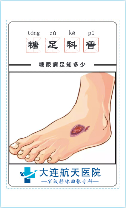 大连航天血管病专科医院|糖尿病足病的早期筛查