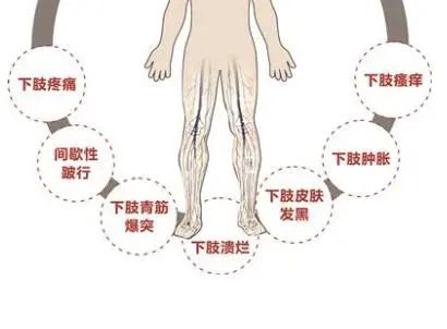 下肢