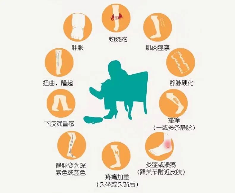 静脉曲张四大危害不容忽视 