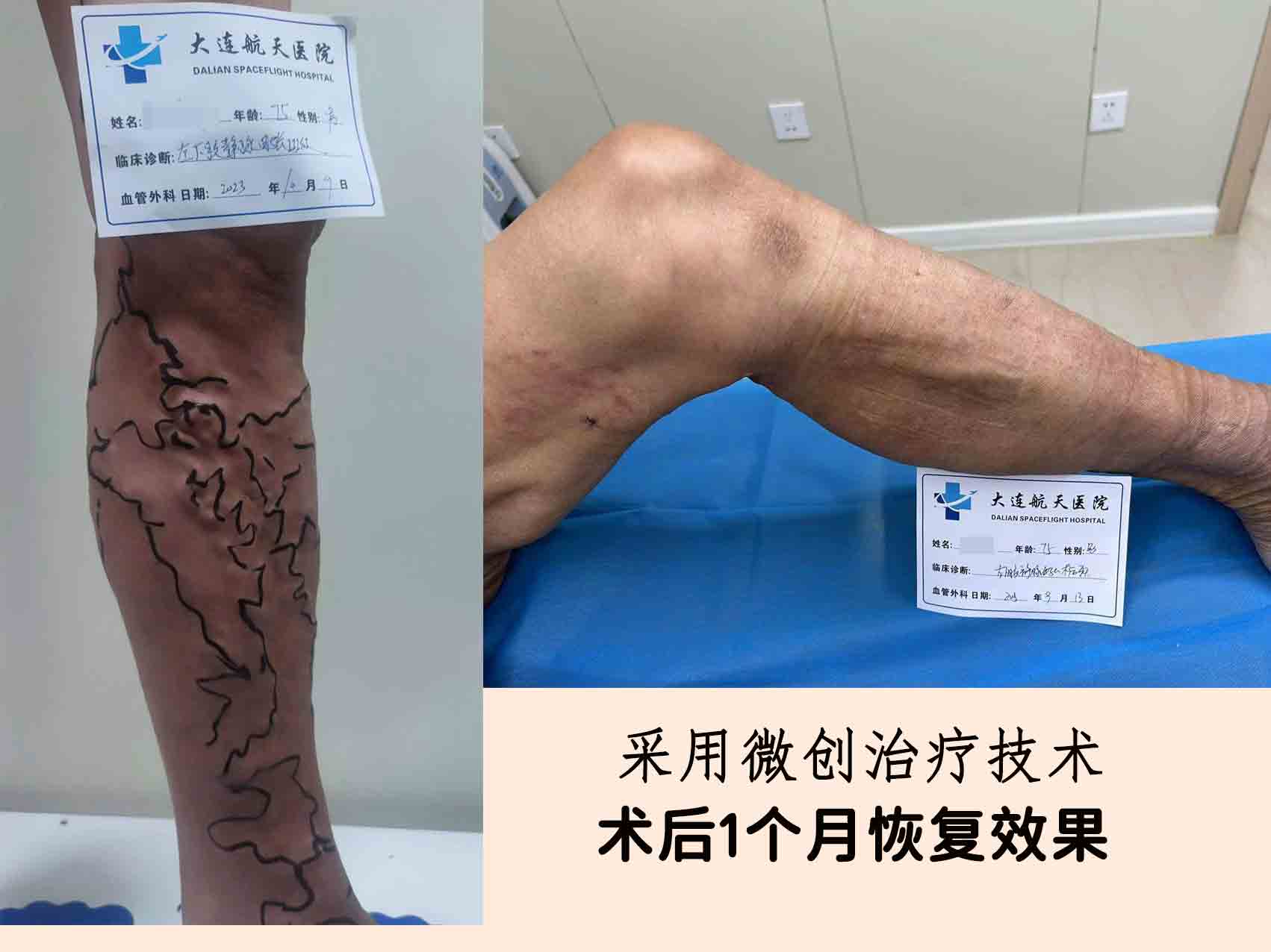 治疗后-(1)110
