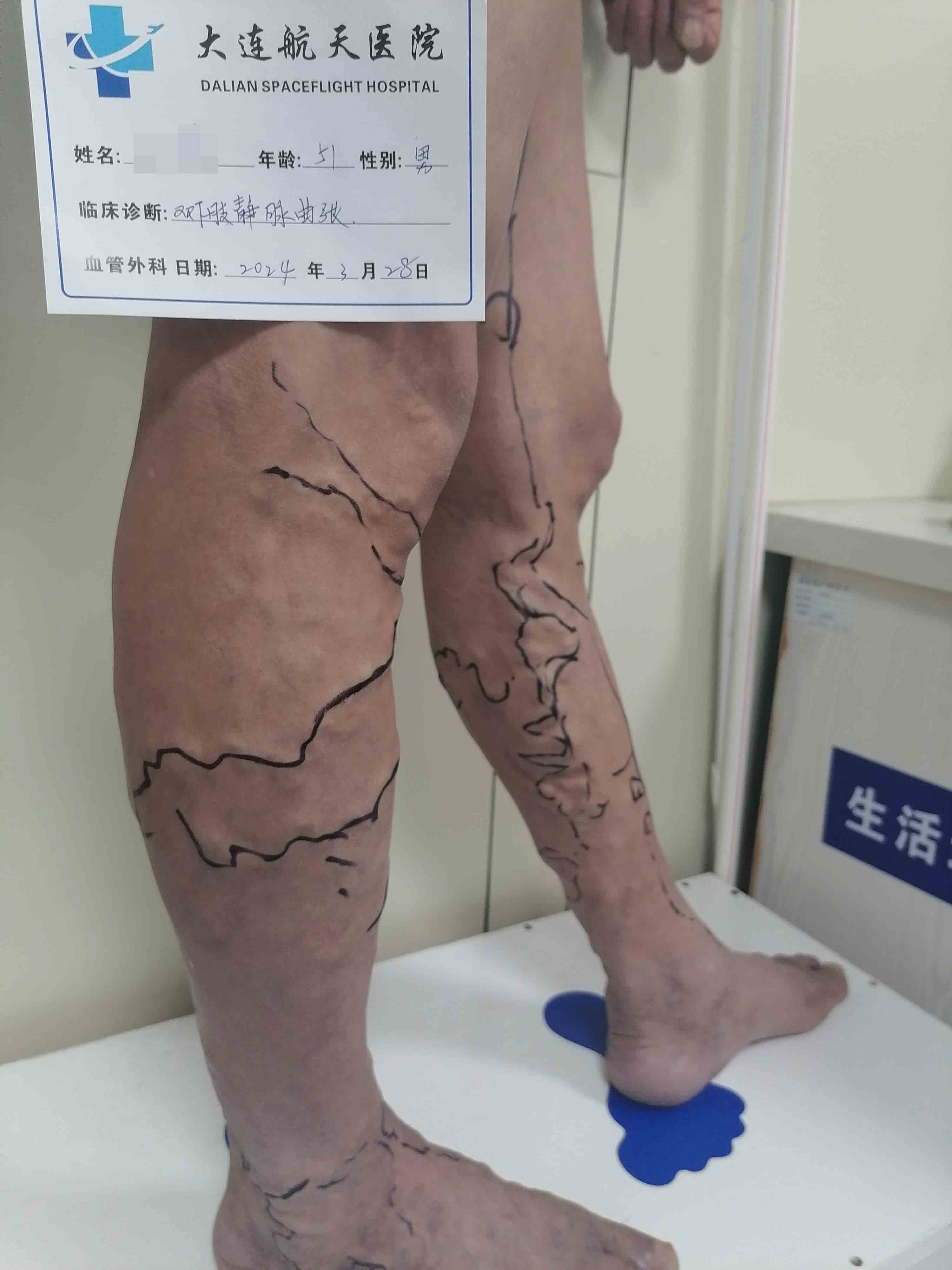 术前JPG