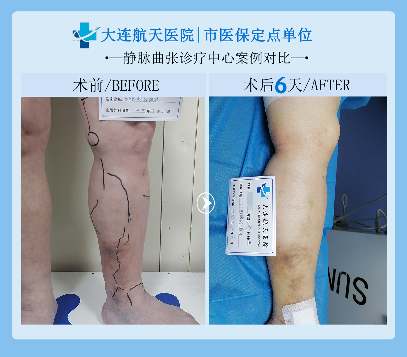 唐案例对比