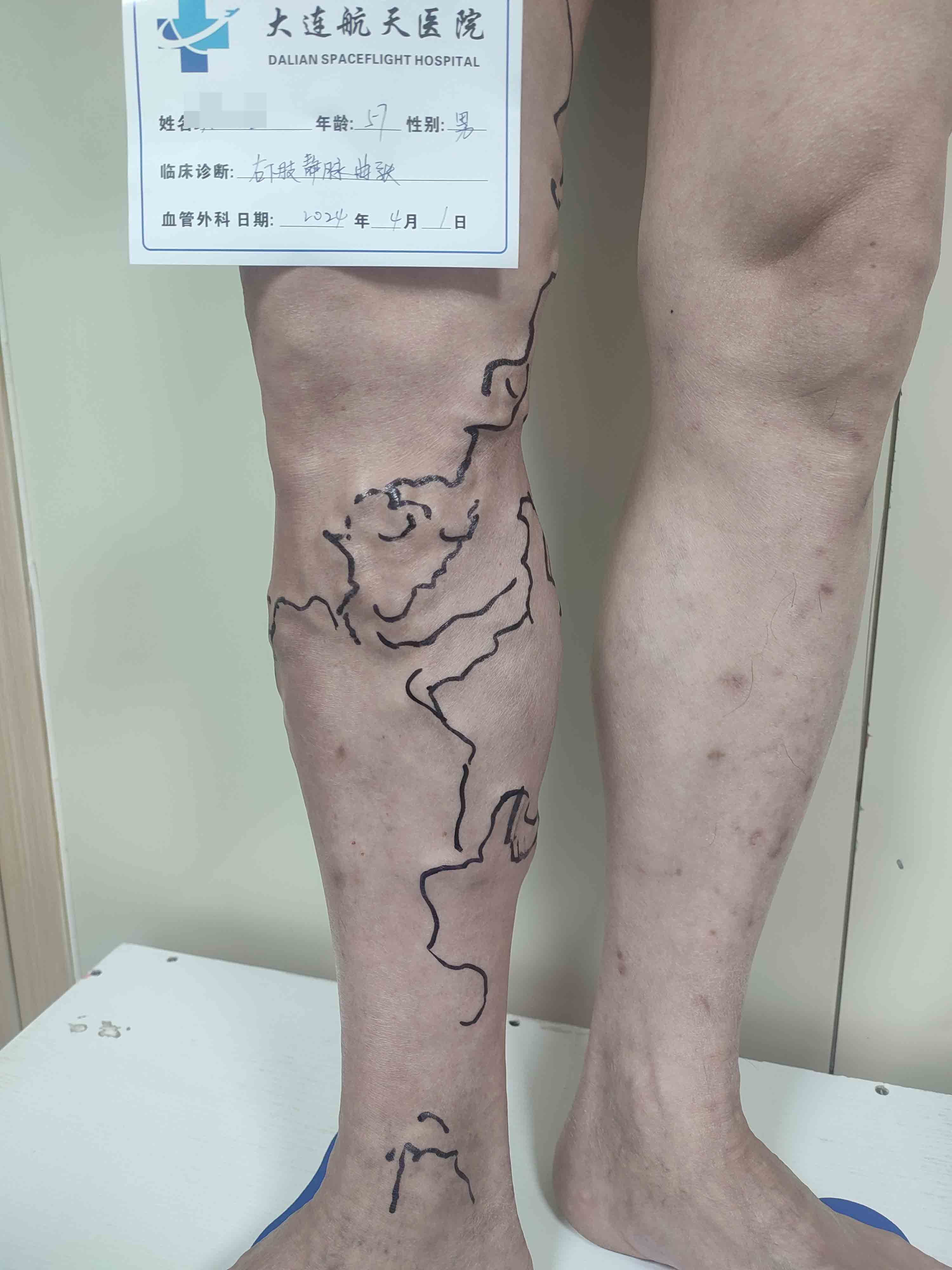 修好