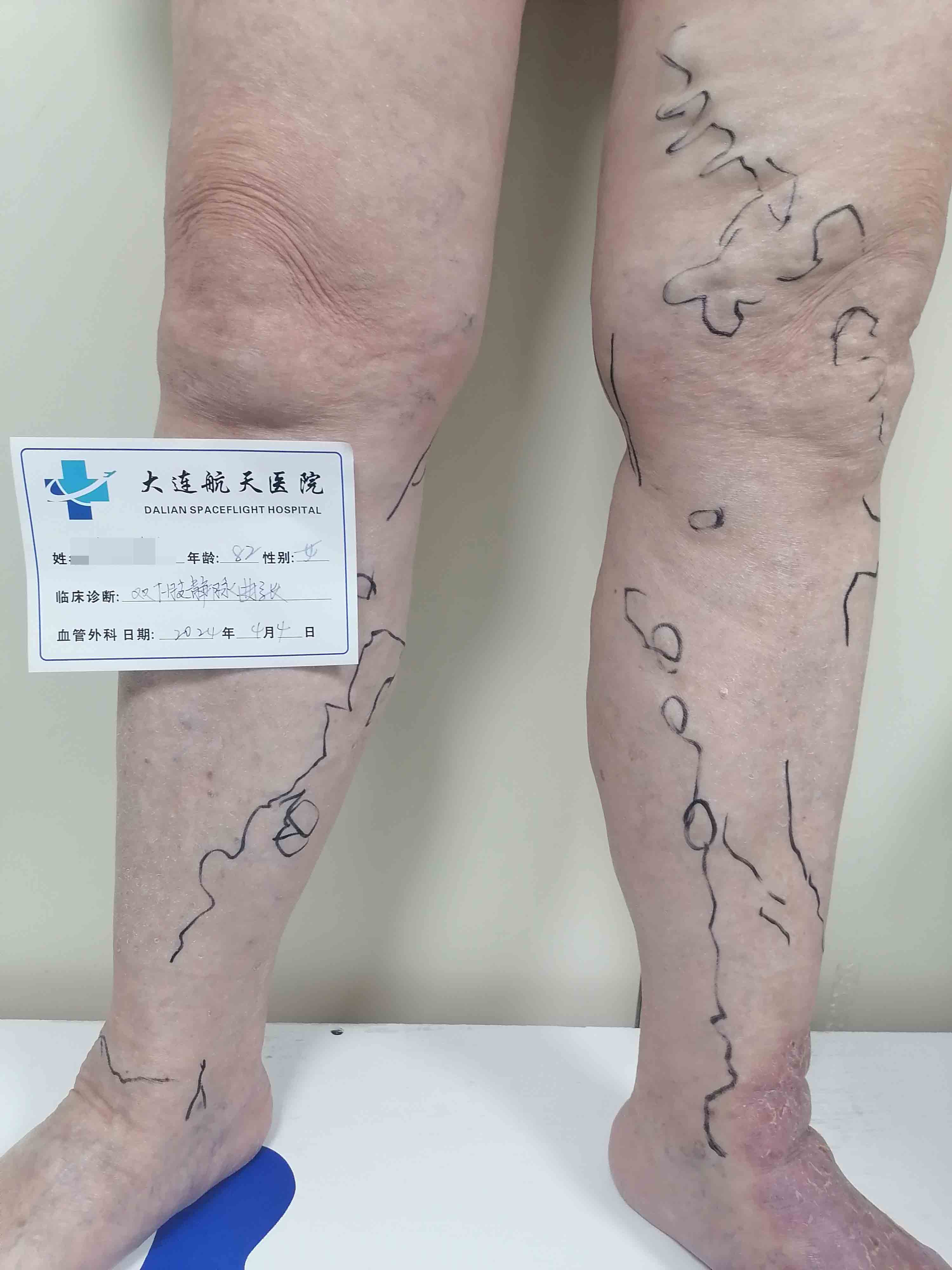 李永建双下肢