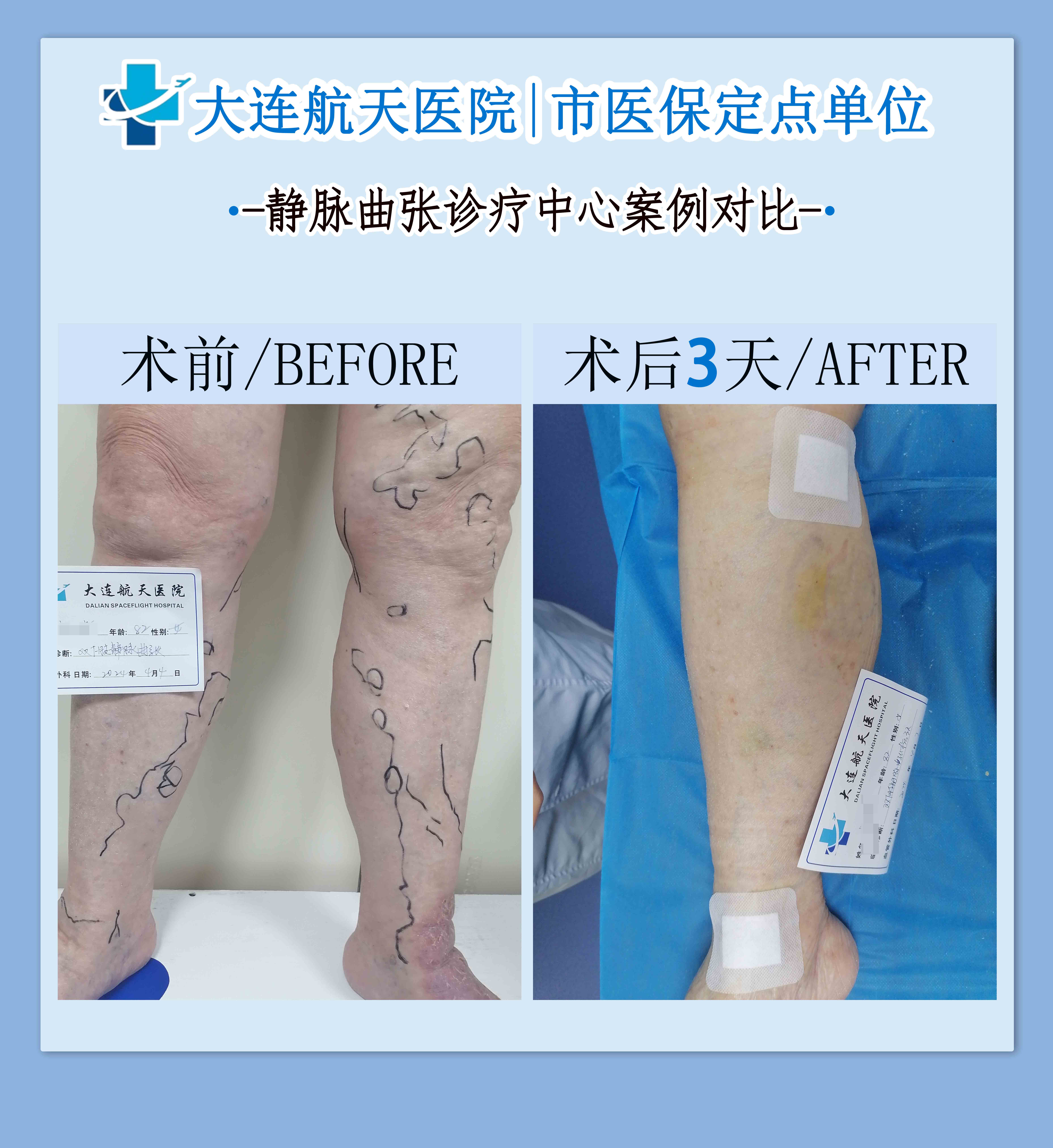 李永建