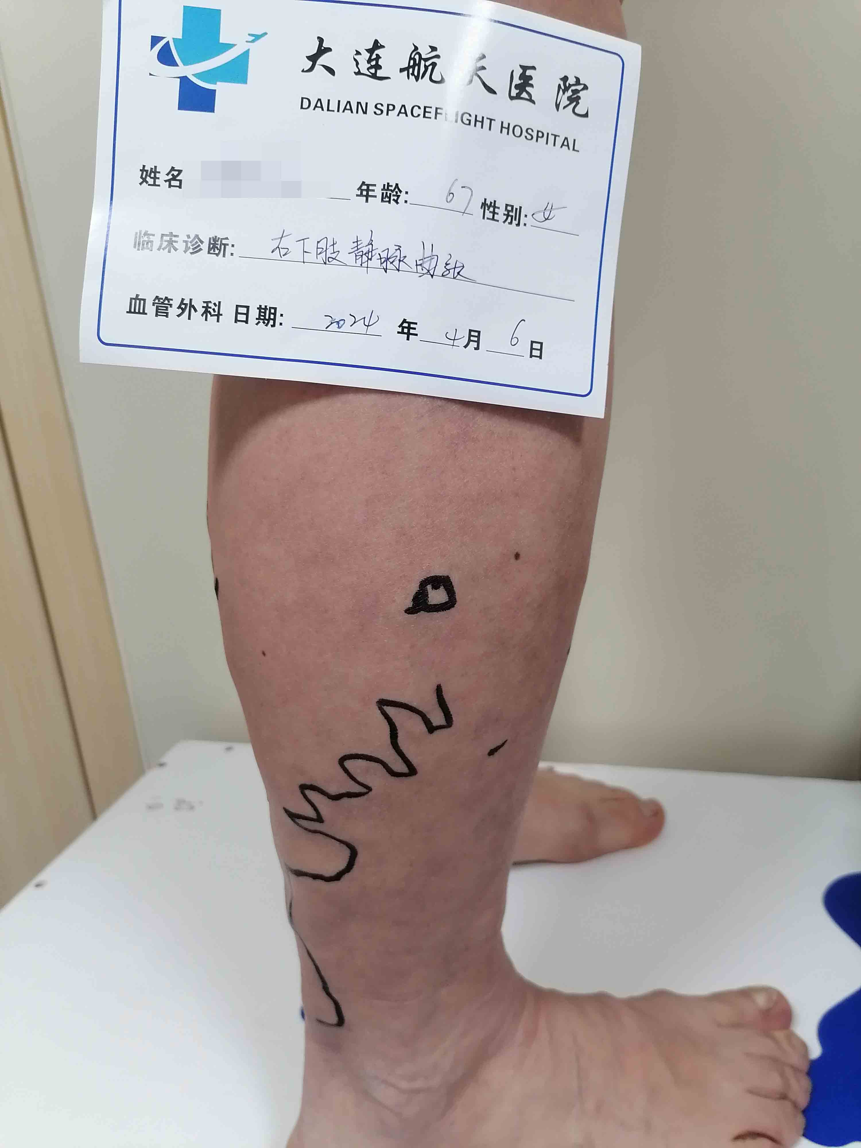 姜术前1