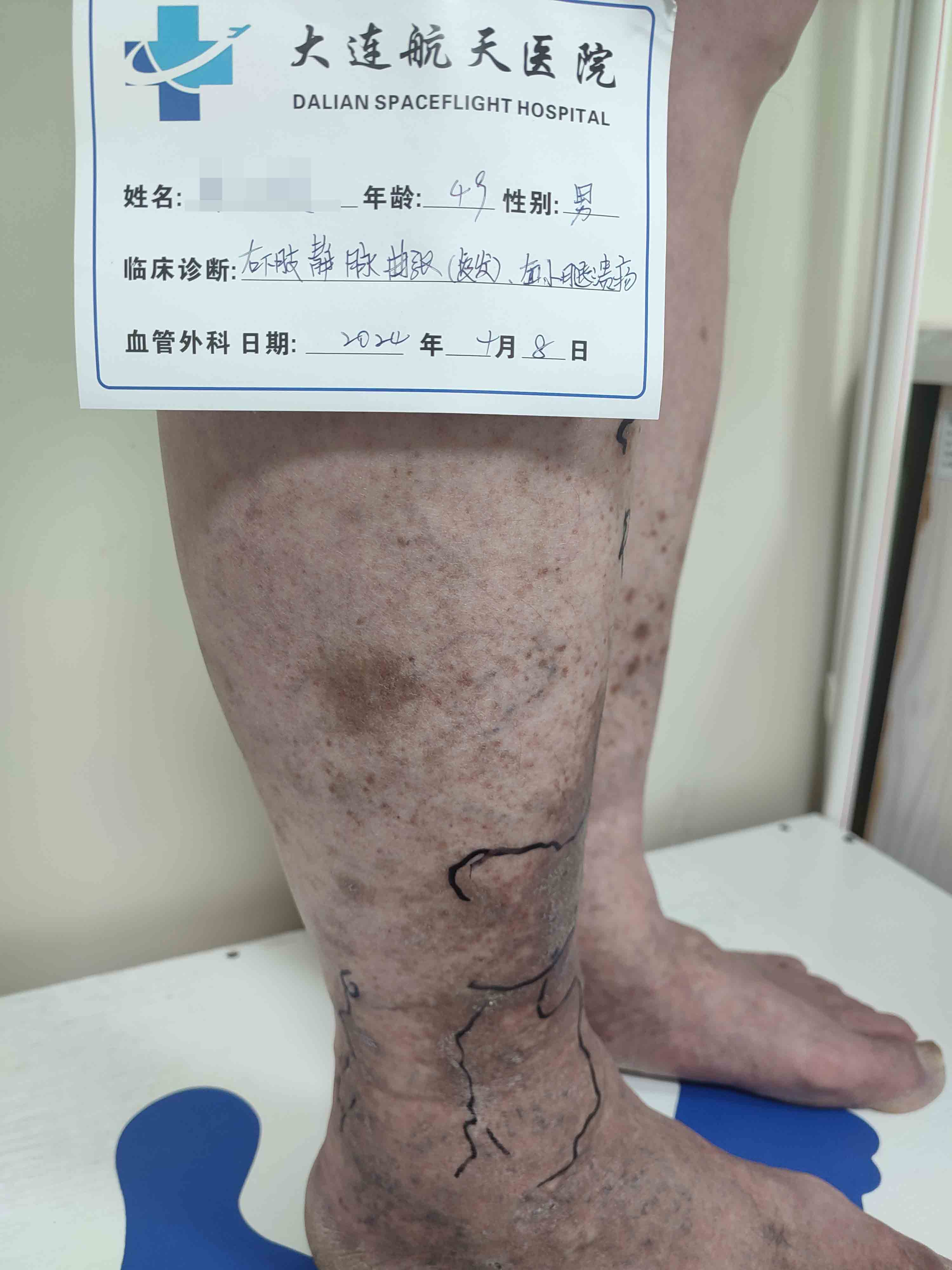 术前2JPG