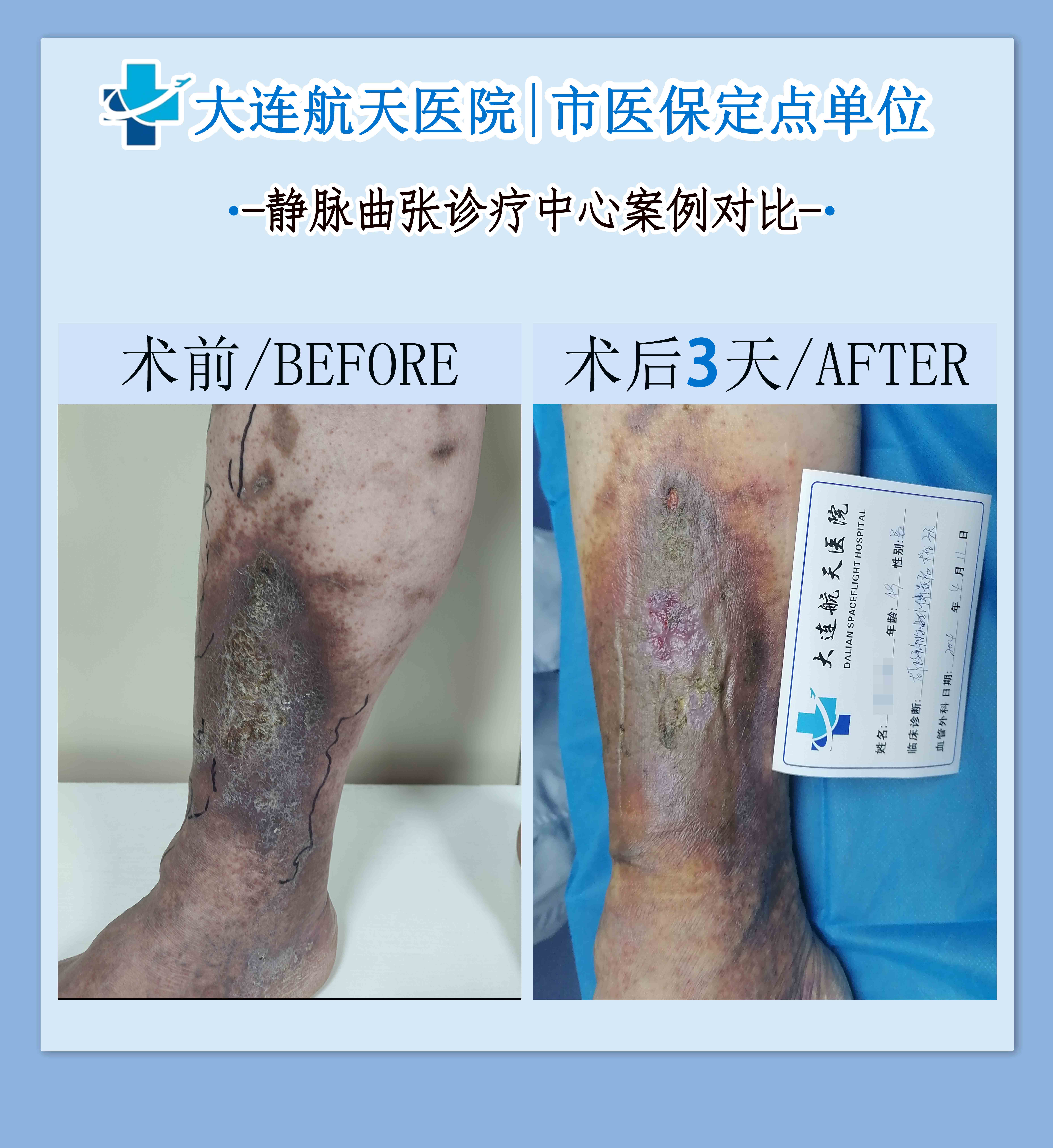郭江政案例对比