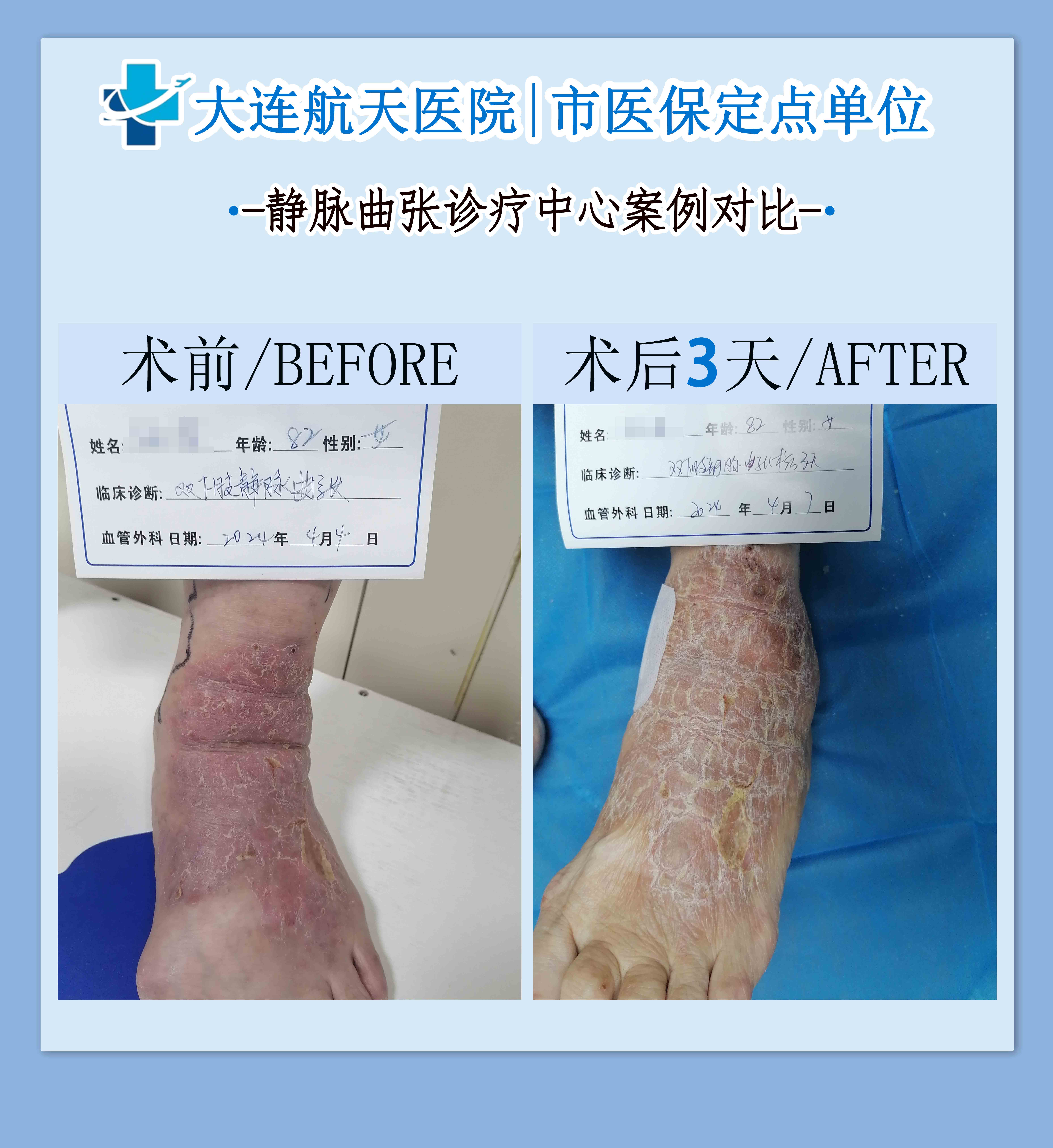 李永健烂腿对比
