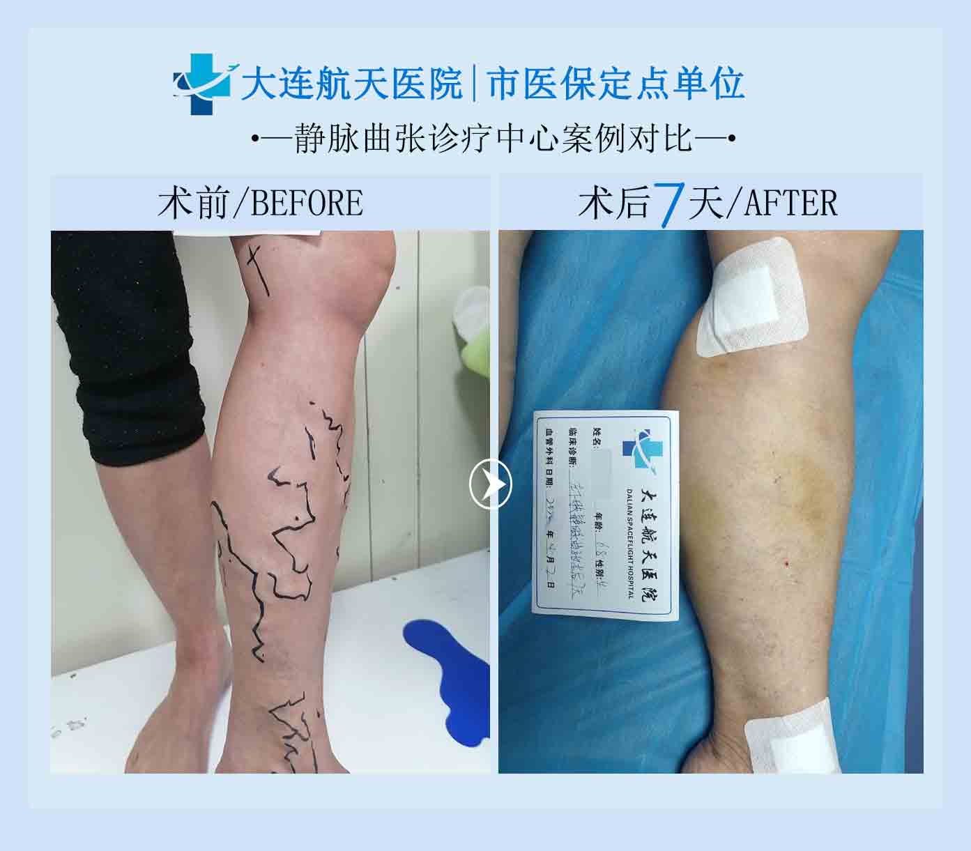 郭女士案例对比