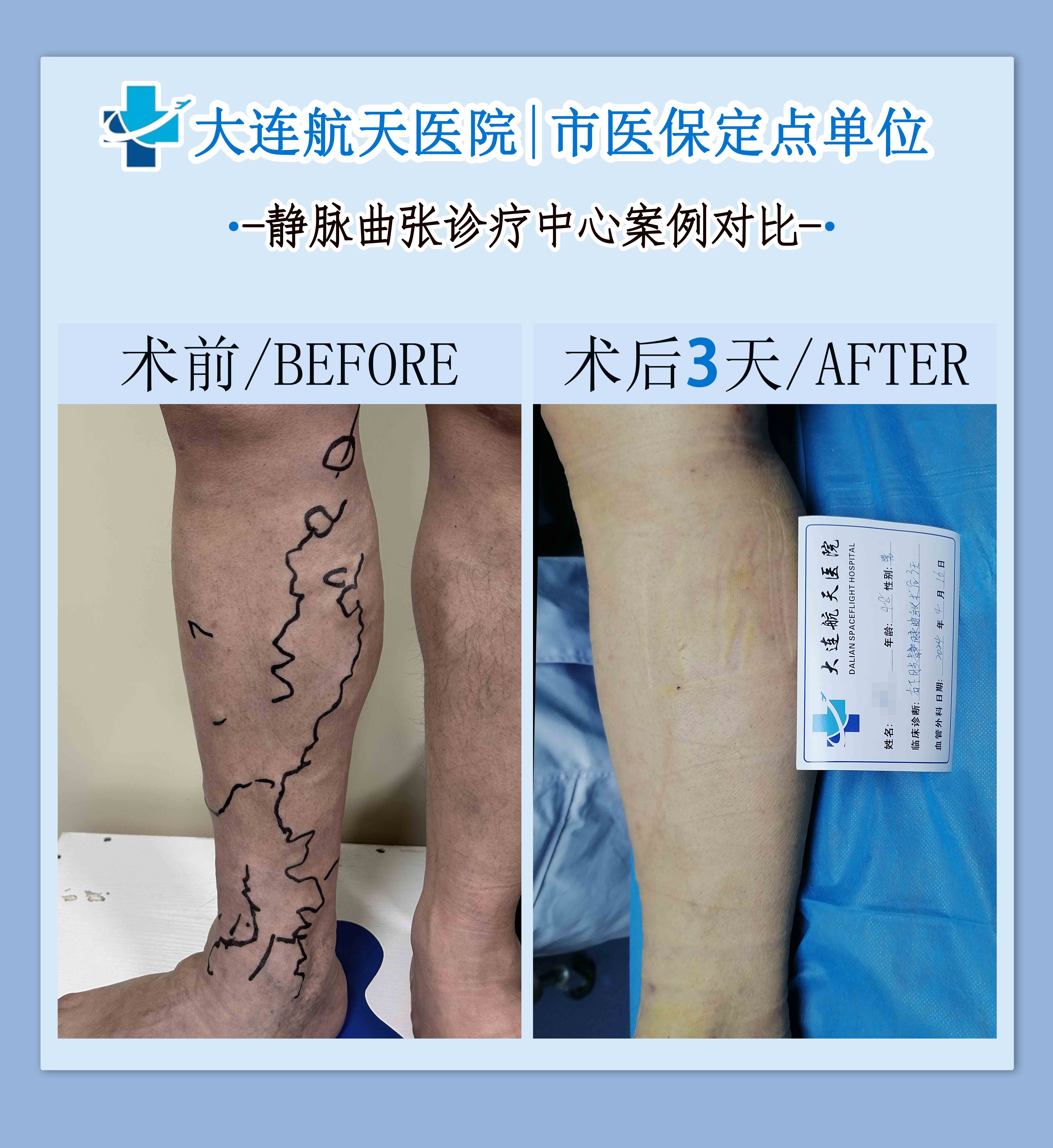 冯昊案例对比jpg