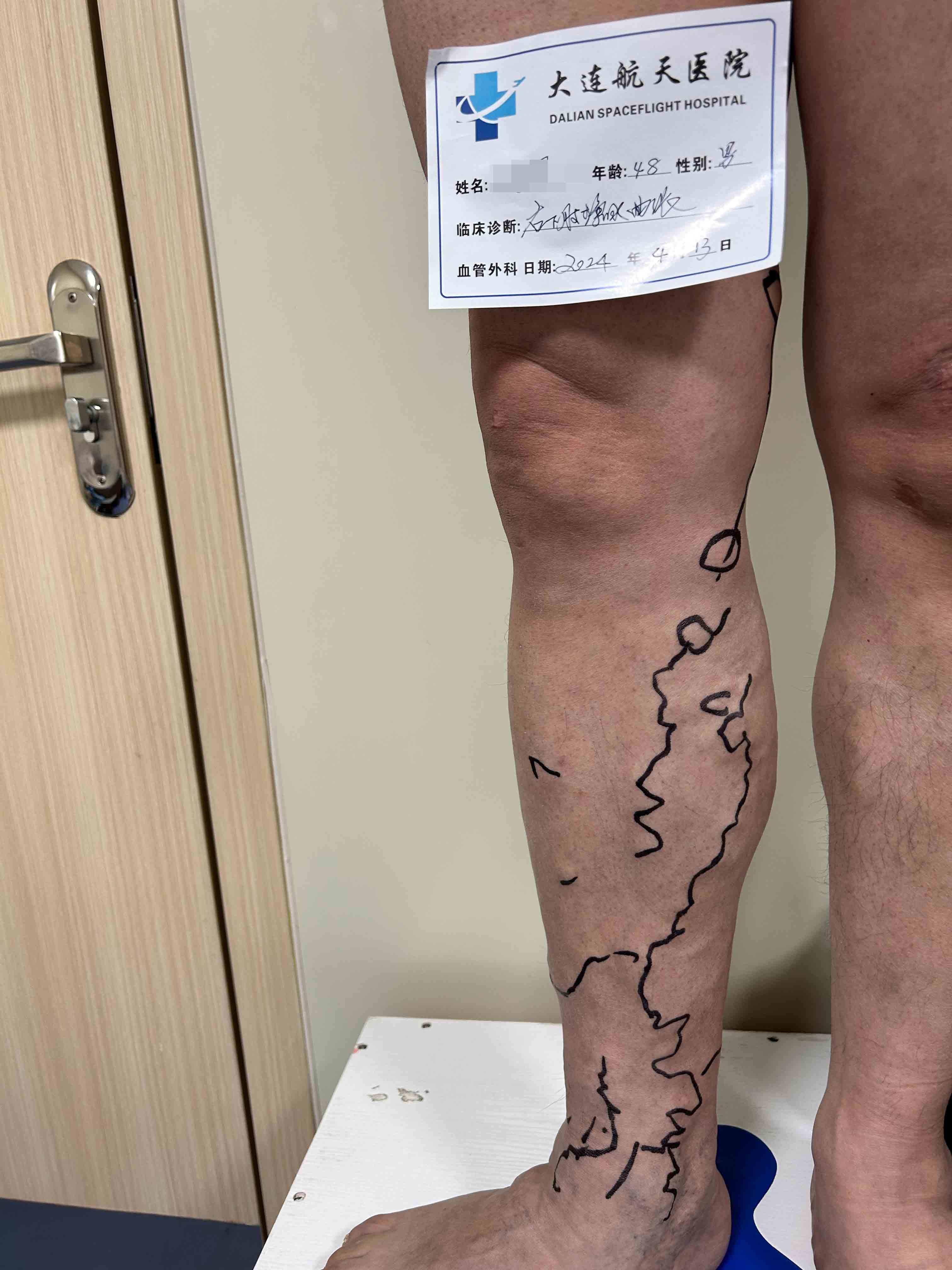 术前冯