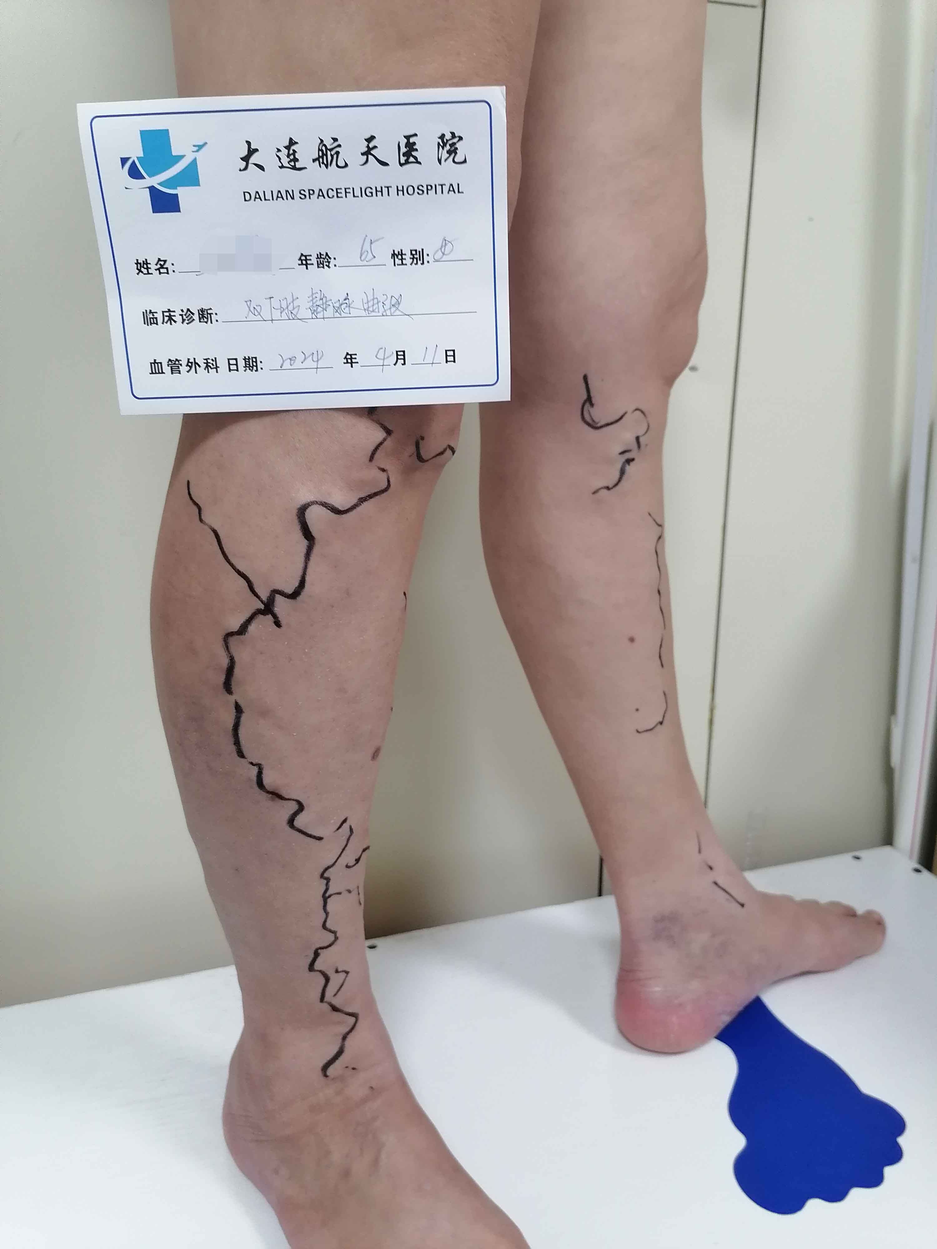 术前
