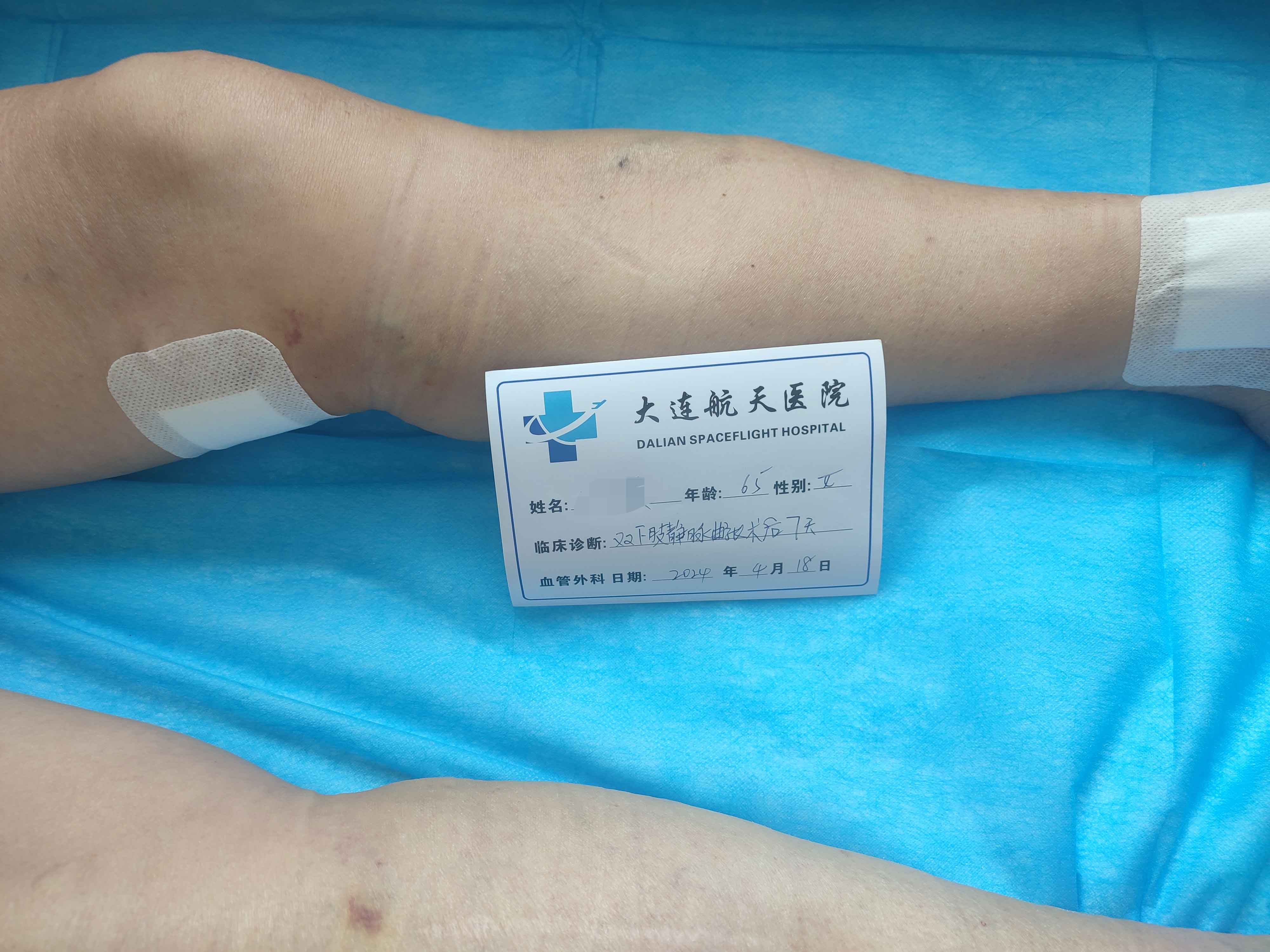 术后7