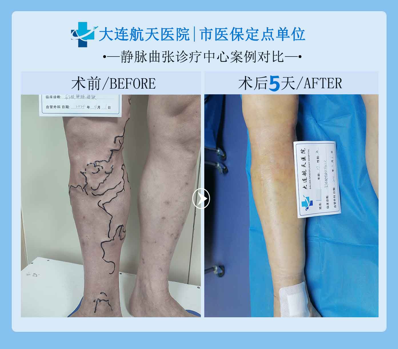 窦对比