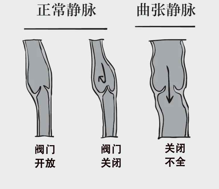 静脉