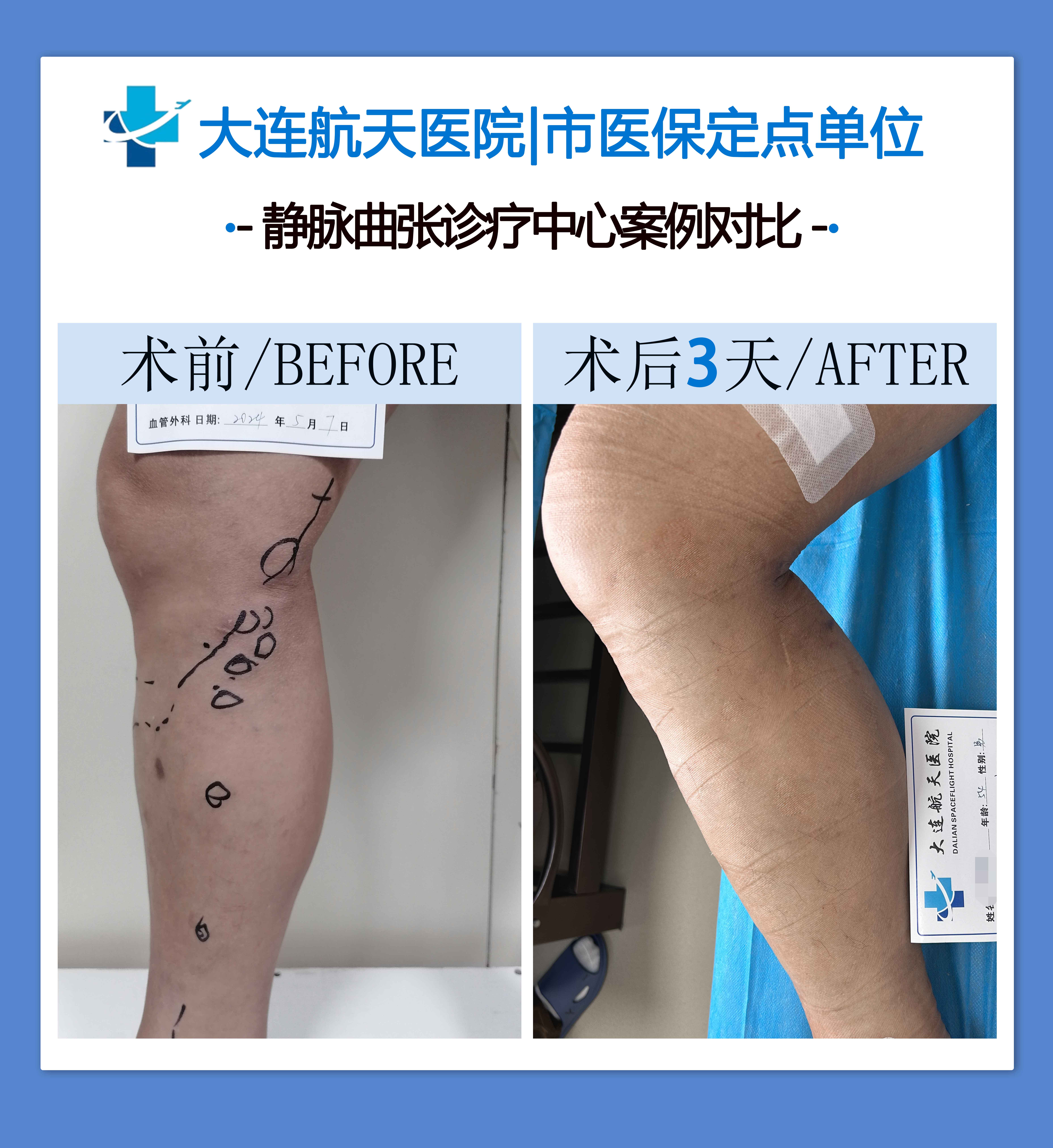 郭福明案对比