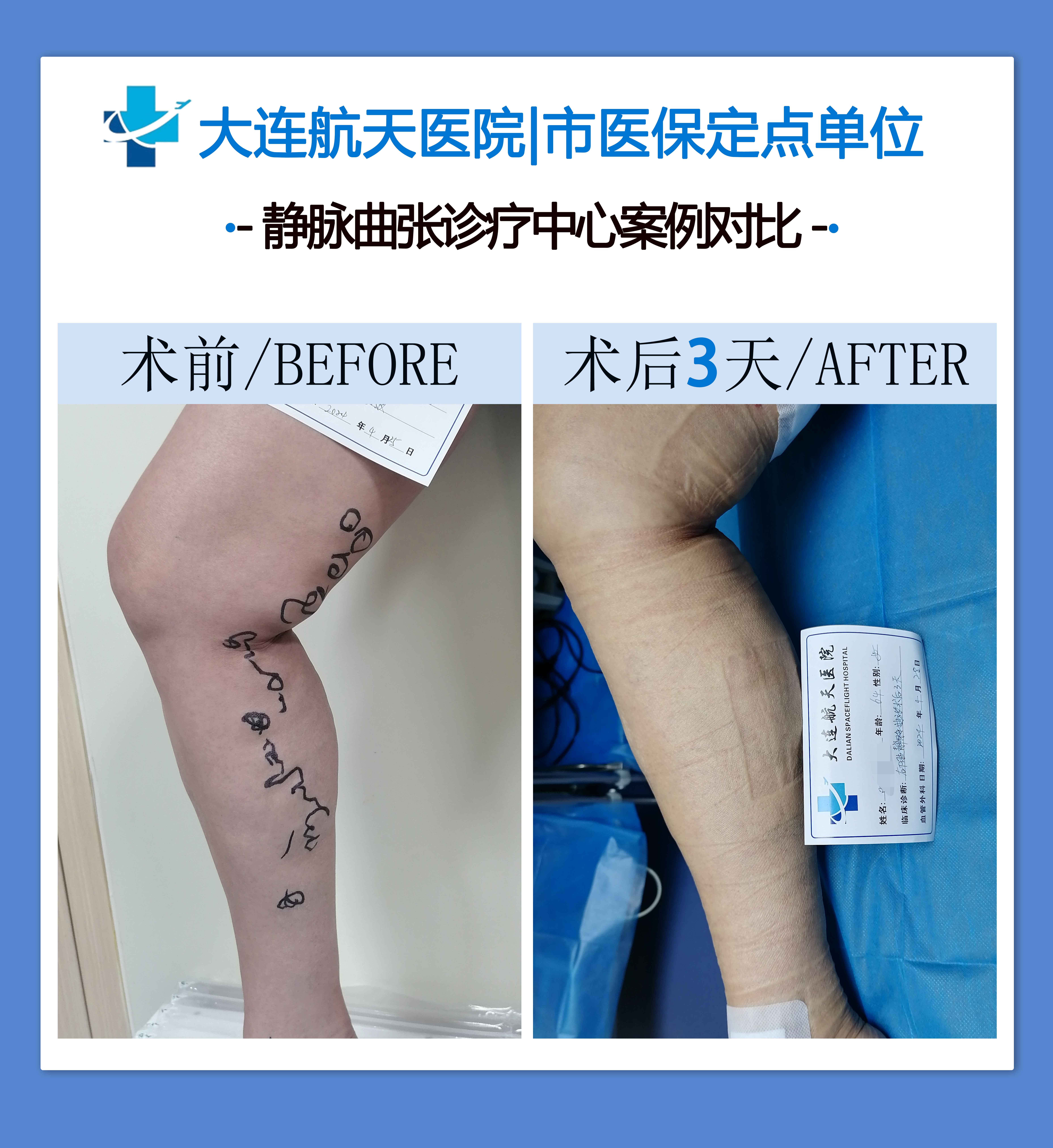 吴国君案例对比