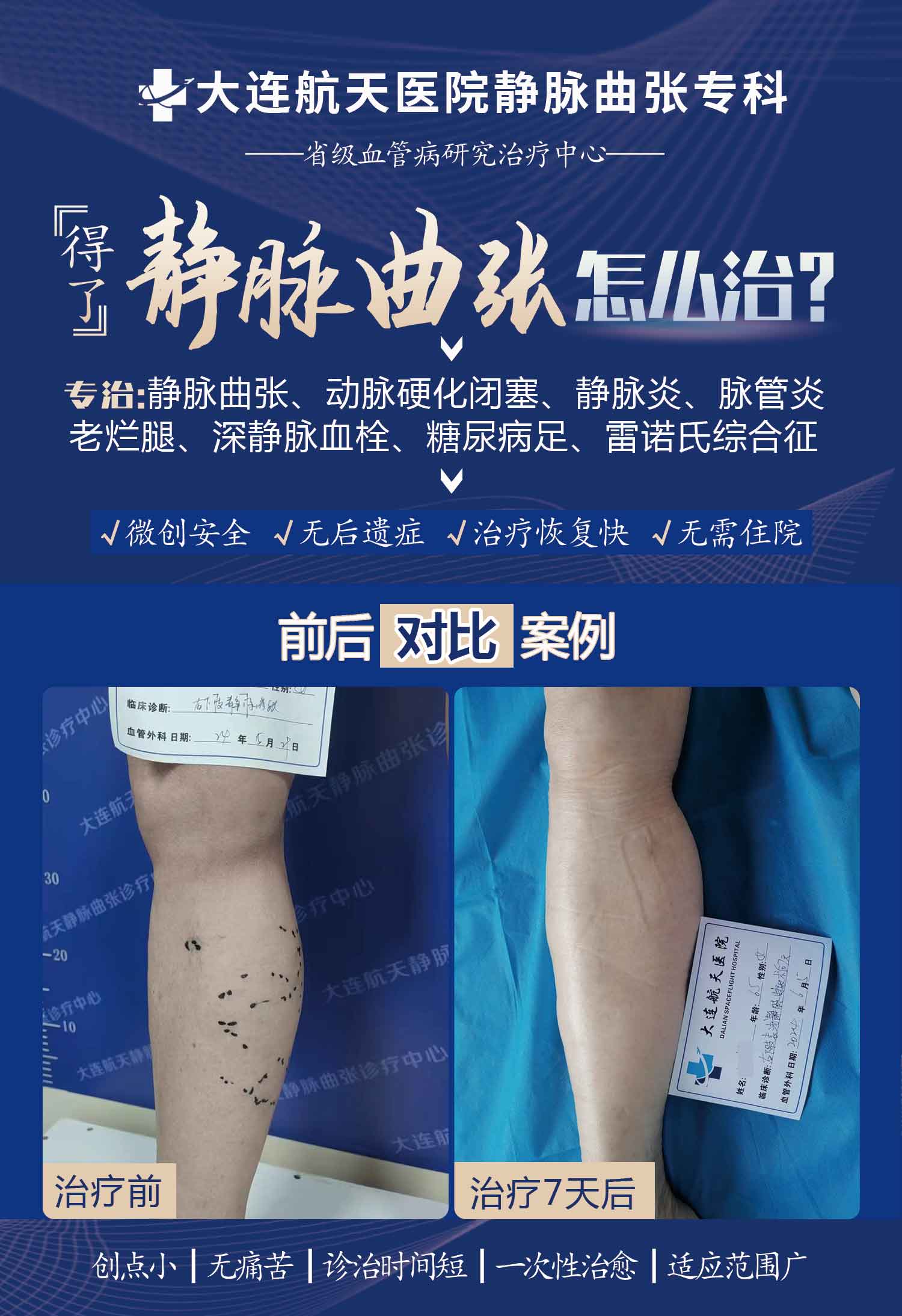 汪华术后7天案例对比