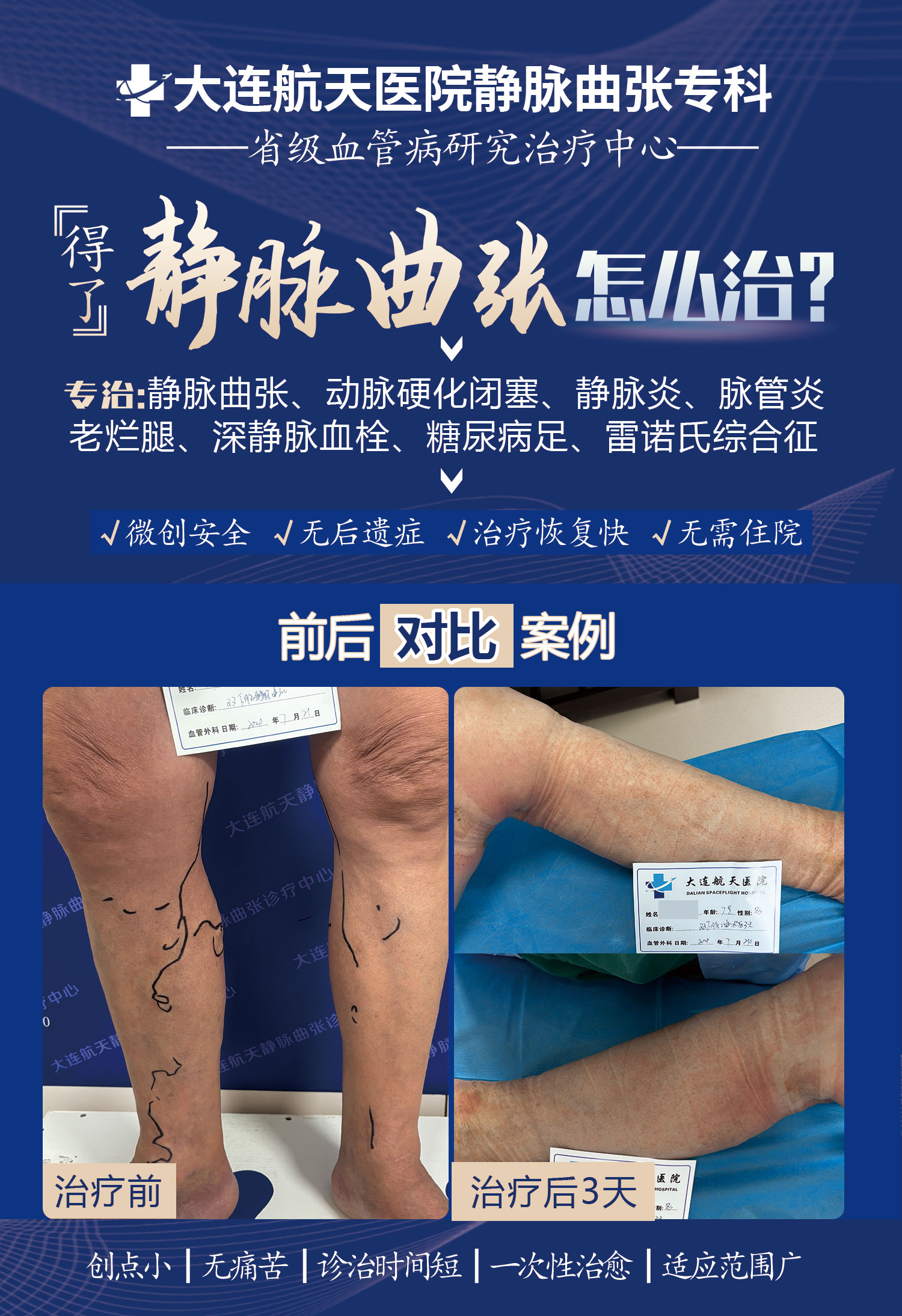 刘志晗术后3天案例对比