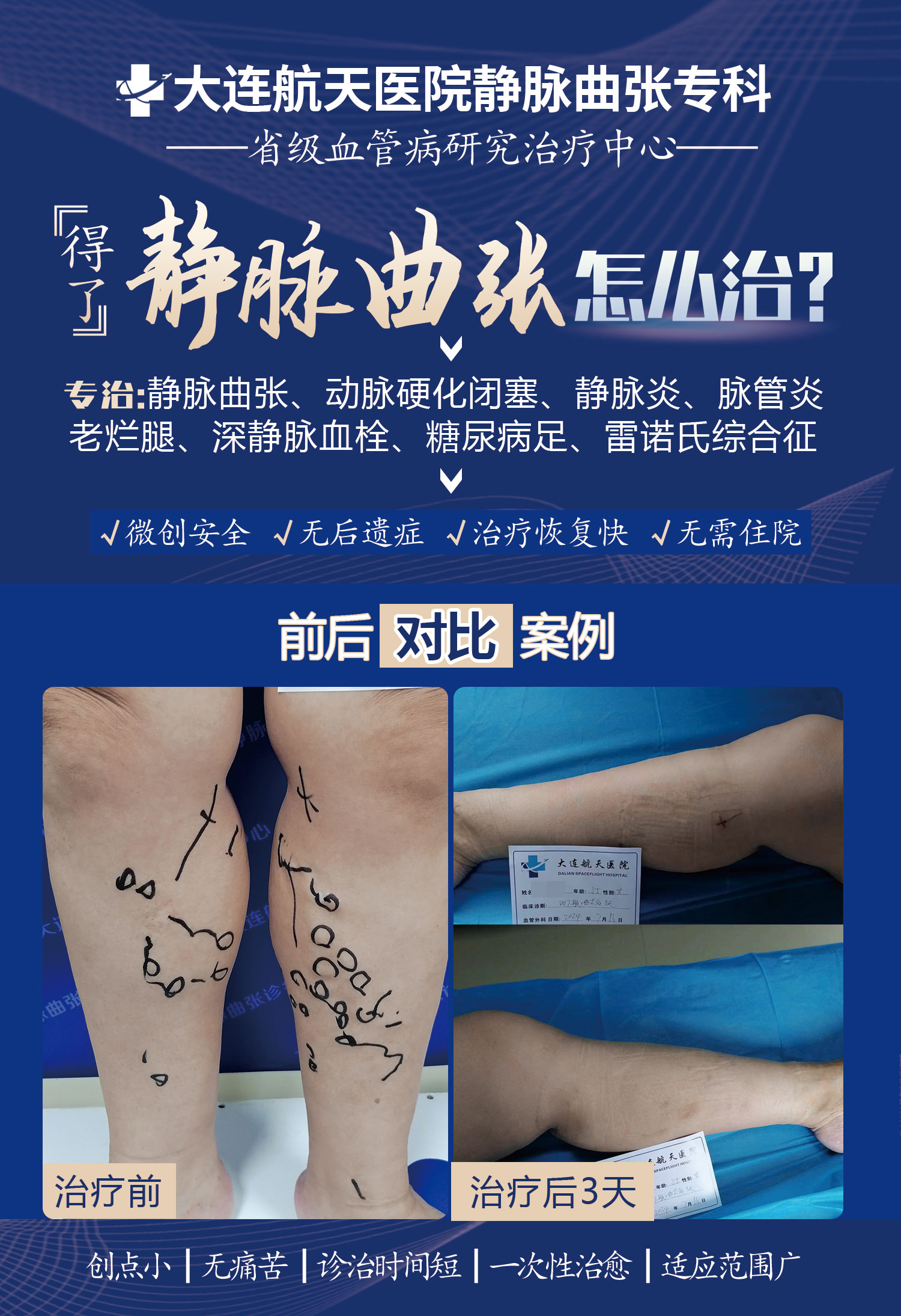 李淑芬术后3天