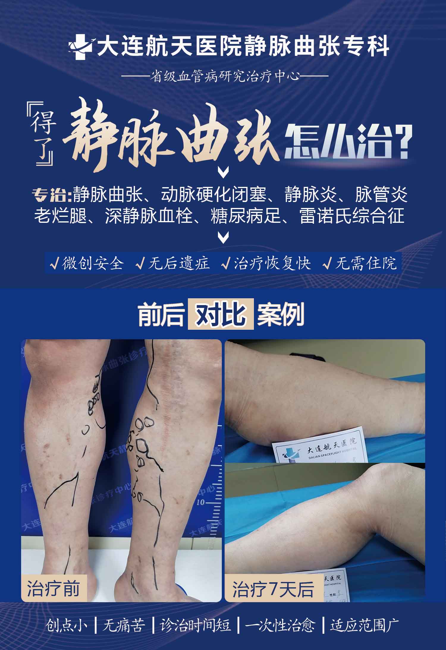 张锡民7天术后案例对比