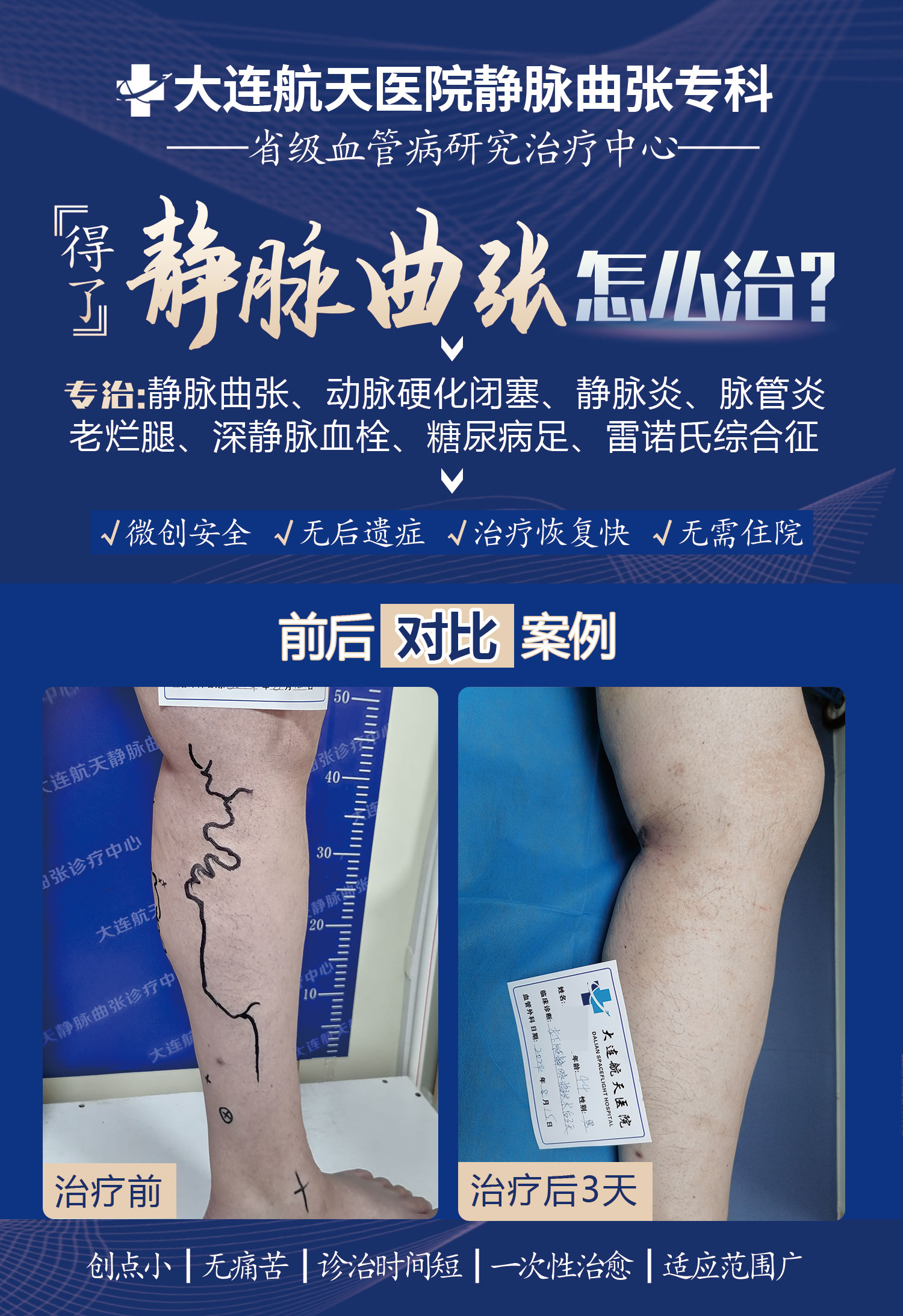 谭伟术后3天案例对比