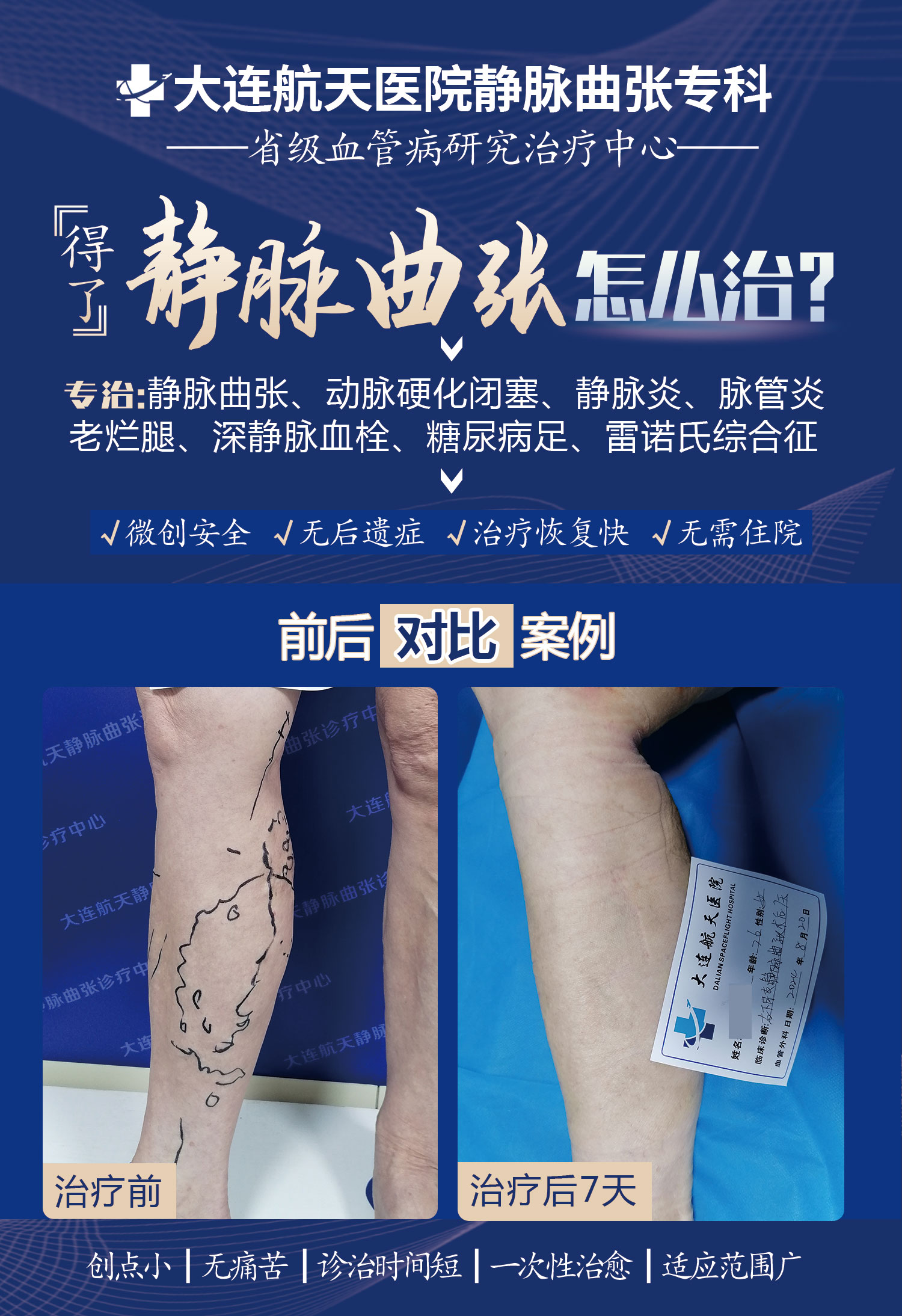 刘光荣术后7天案例对比
