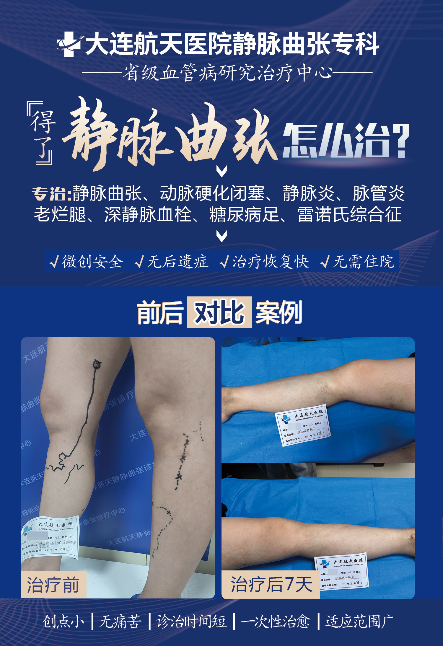 刘翠君术后7天案例对比