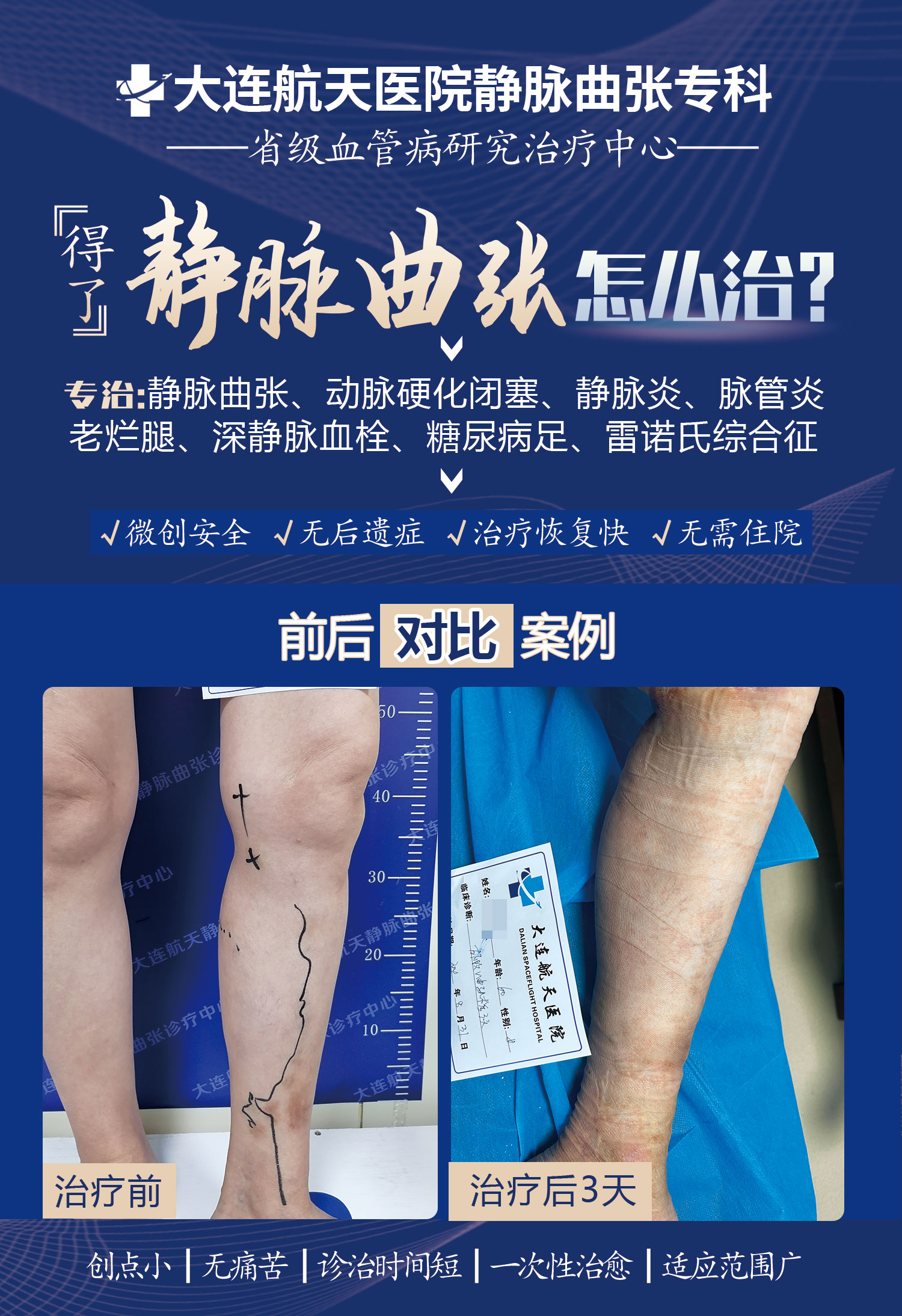 王金香术后3天案例对比2024