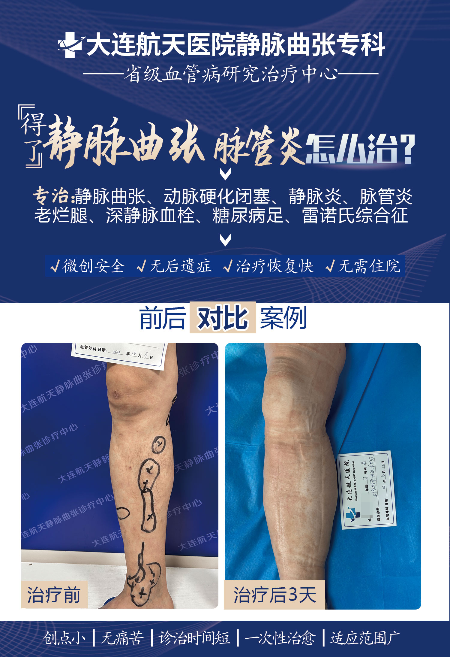 大连王虎成术后
