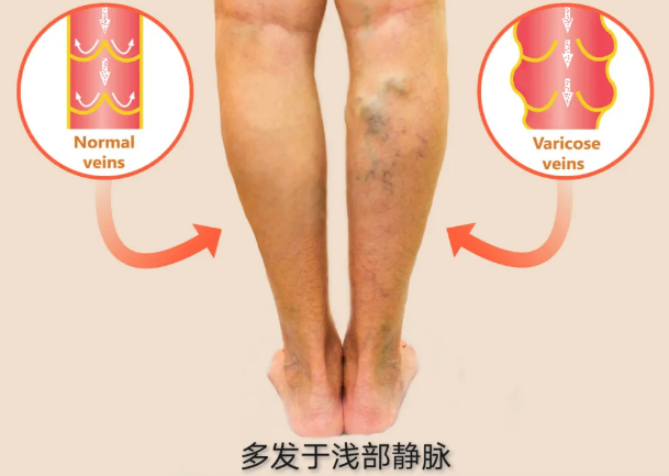 双腿