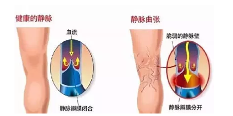 微信
