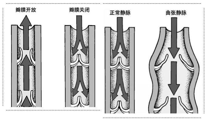 瓣膜