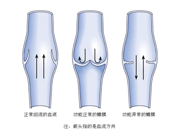 血流方向