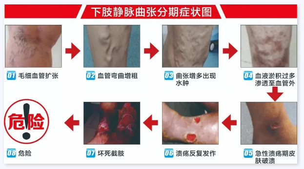 过程17