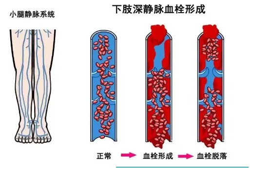 形成